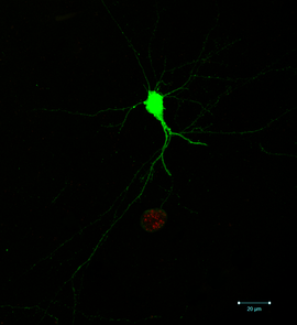 A single infected neuron. The ability to identify which neurons are infected, and which part of the neuron is infected, relies on the parasite-induced expression of green fluorescent protein in the neuron as well as the expression of a red fluorescent protein by the parasites themselves. (Photo: Anita Koshy) A single infected neuron. The ability to identify which neurons are infected, and which part of the neuron is infected, relies on the parasite-induced expression of green fluorescent protein in the neuron as well as the expression of a red fluorescent protein by the parasites themselves. (Photo: Anita Koshy)