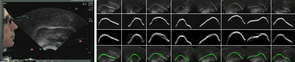 The top row in the image to the right indicates ultrasound inputs. The second row represents tongue contours drawn by a human. The third row represents the automatic system’s raw output, with the bottom row showing the contour after they had been processed. (Image courtesy of: Diana Archangeli and Ian Fasel) The top row in the image to the right indicates ultrasound inputs. The second row represents tongue contours drawn by a human. The third row represents the automatic system’s raw output, with the bottom row showing the contour after they had been processed. (Image courtesy of: Diana Archangeli and Ian Fasel)