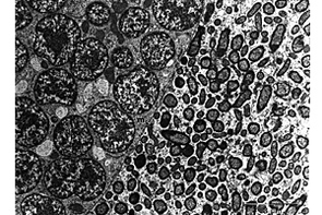 Electron micrograph of bacteria living inside the body of a pea aphid. The small circles and ovals on the right side of the picture are T-type bacteria that protect the aphid from parasitic wasps. The larger circles at the left are another type of beneficial bacteria, called Buchnera, which live in all aphids. (Photo: Joshua White) Electron micrograph of bacteria living inside the body of a pea aphid. The small circles and ovals on the right side of the picture are T-type bacteria that protect the aphid from parasitic wasps. The larger circles at the left are another type of beneficial bacteria, called Buchnera, which live in all aphids. (Photo: Joshua White)