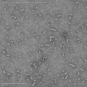 A negative stain electron micrograph of SgrAI/DNA filaments. (Courtesy: Nancy Horton) A negative stain electron micrograph of SgrAI/DNA filaments. (Courtesy: Nancy Horton)