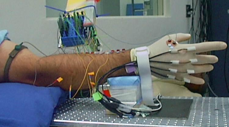 "Moving an arm can involve more than 50 different muscles," UA professor Andrew Fuglevand said. "Replicating how the brain naturally coordinates the activities of these muscles is extremely challenging." "Moving an arm can involve more than 50 different muscles," UA professor Andrew Fuglevand said. "Replicating how the brain naturally coordinates the activities of these muscles is extremely challenging."