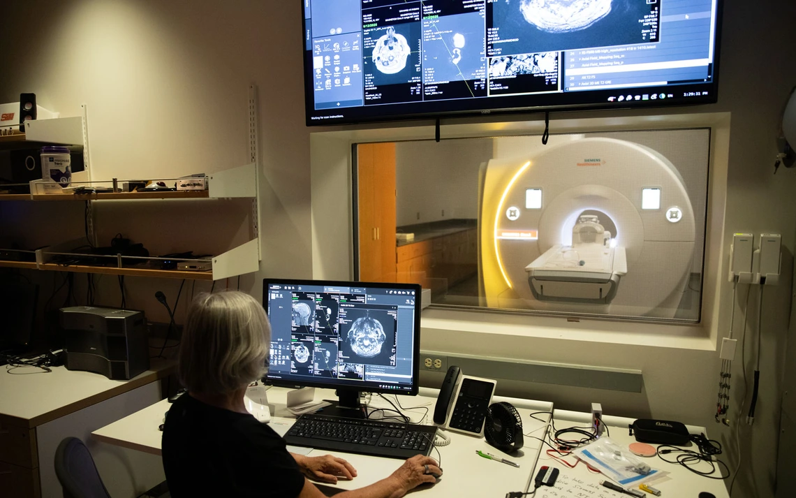 Monitors display scans created by MRI machine