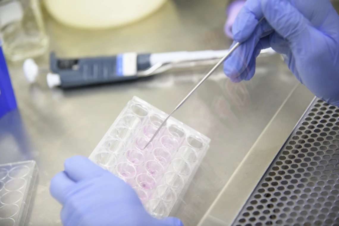 Medical test tubes