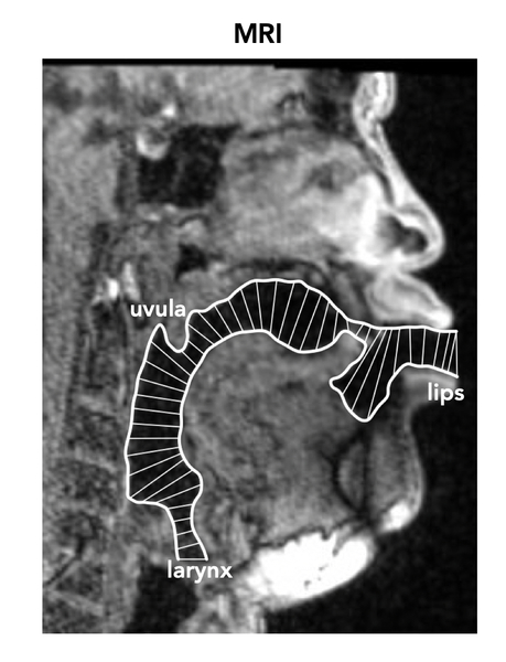 An MRI scan of a person throat singing shows their lips, uvula, and larynx