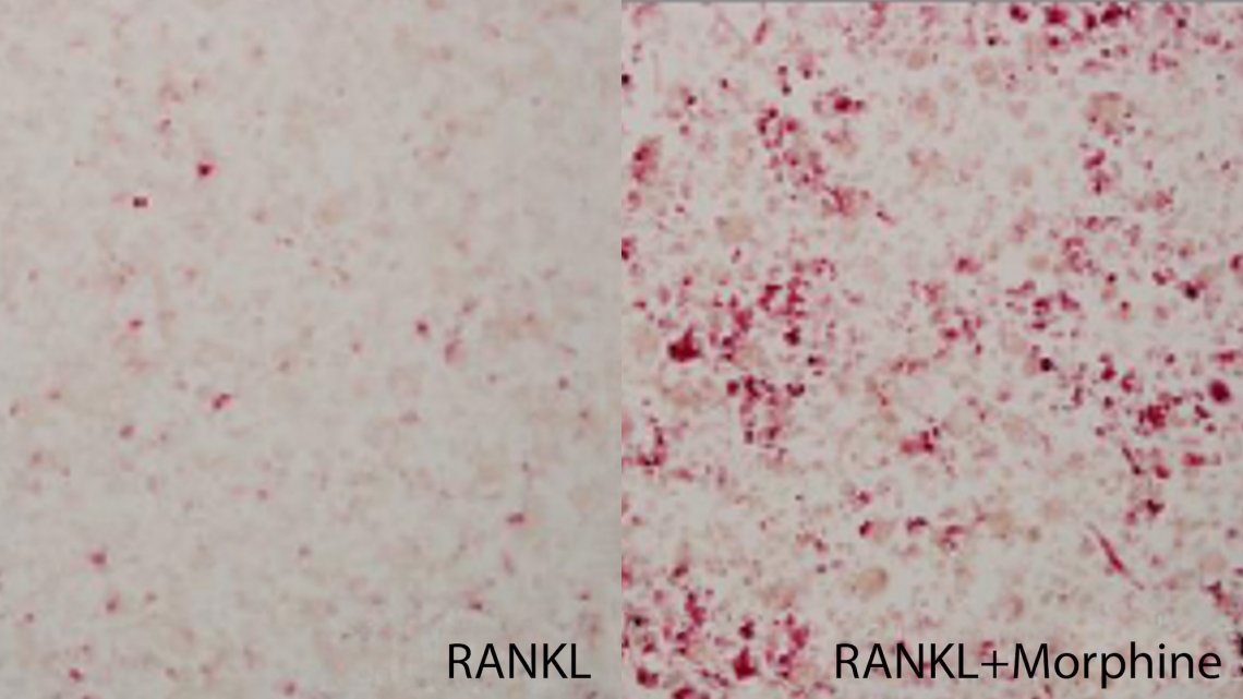 cells isolated from breast cancer cells
