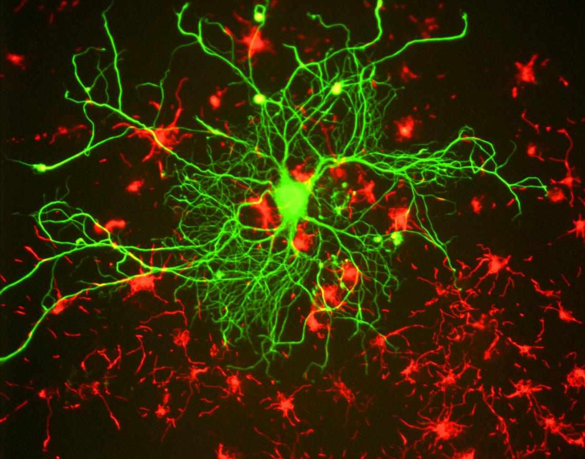 This image of a neuron in tissue culture reveals an extensive network of filaments. This image of a neuron in tissue culture reveals an extensive network of filaments.