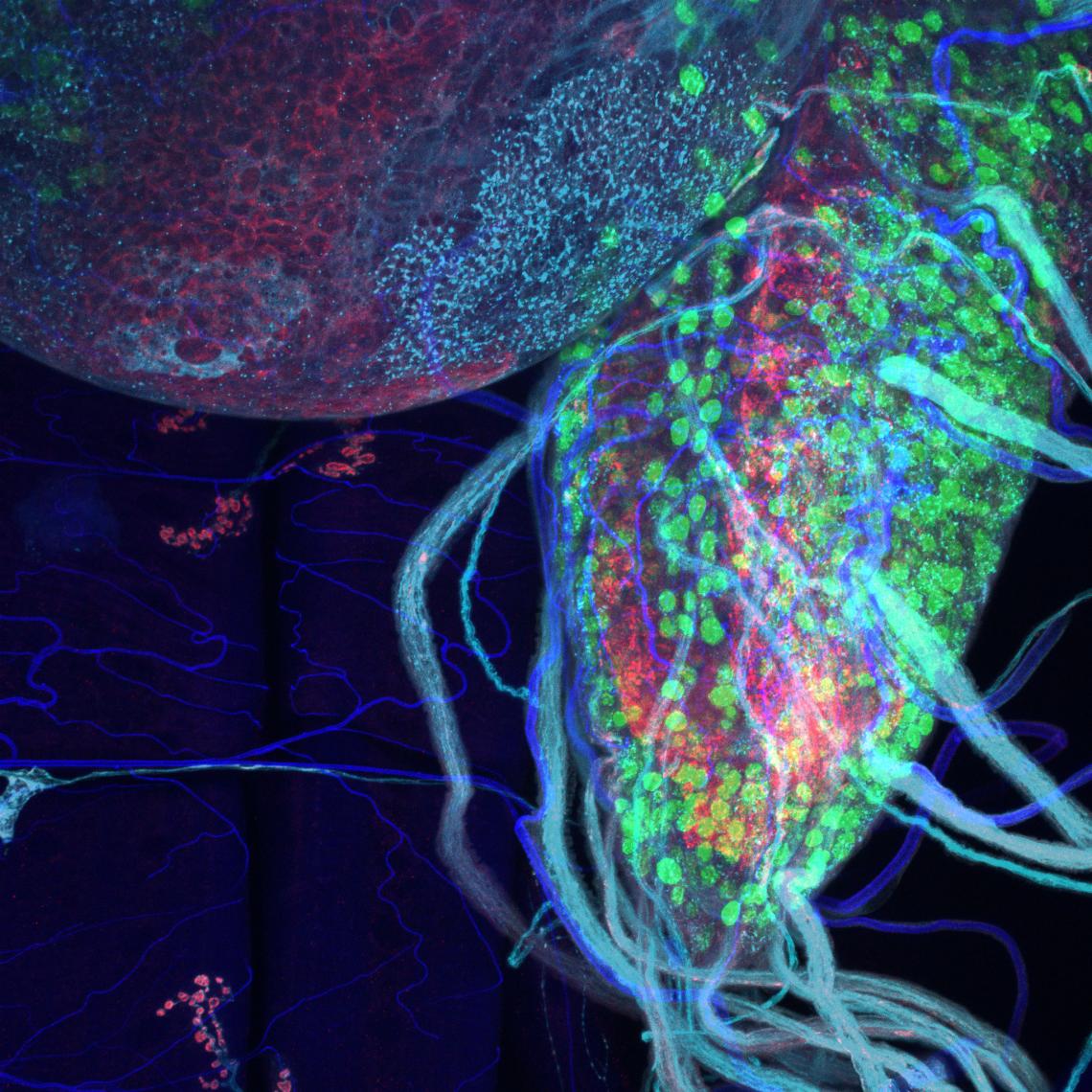 The researchers observed brain lobes of ALS-affected fruit flies under a microscope. Pictured is a nerve cord, populated with green-stained motor neurons, expressing human glucose transporters. Areas of neurotransmitter release are shown in red, while mus The researchers observed brain lobes of ALS-affected fruit flies under a microscope. Pictured is a nerve cord, populated with green-stained motor neurons, expressing human glucose transporters. Areas of neurotransmitter release are shown in red, while mus