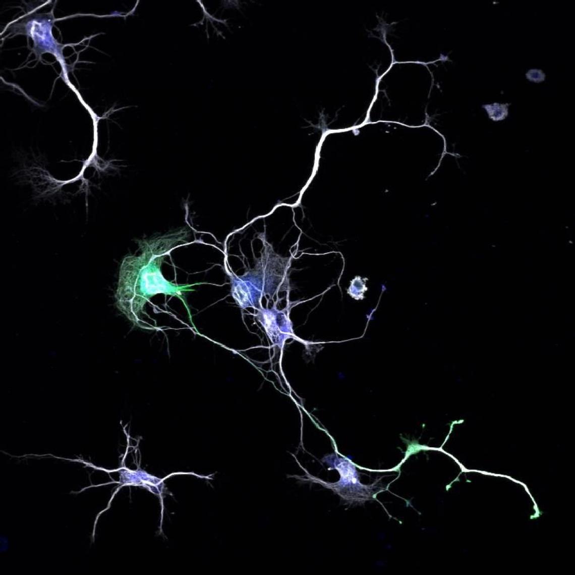 Nerve cells use their dendrites and axons to connect with each other and form neural networks. Nerve cells use their dendrites and axons to connect with each other and form neural networks.
