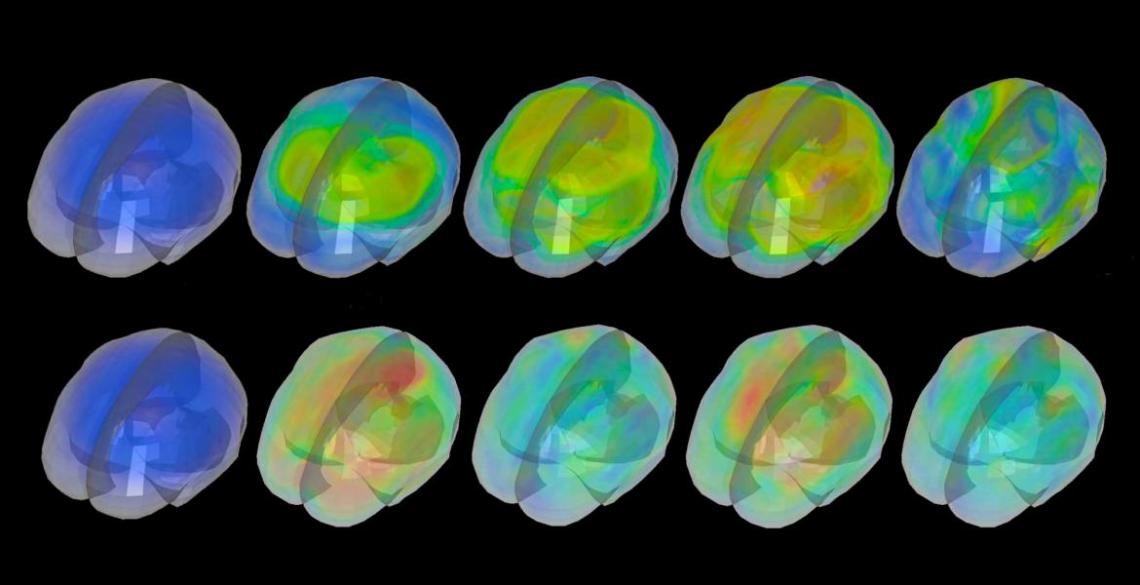 Selected brain scans from a new research paper on the causes of traumatic brain injury by Kaveh Laksari of the UA Department of Biomedical Engineering Selected brain scans from a new research paper on the causes of traumatic brain injury by Kaveh Laksari of the UA Department of Biomedical Engineering