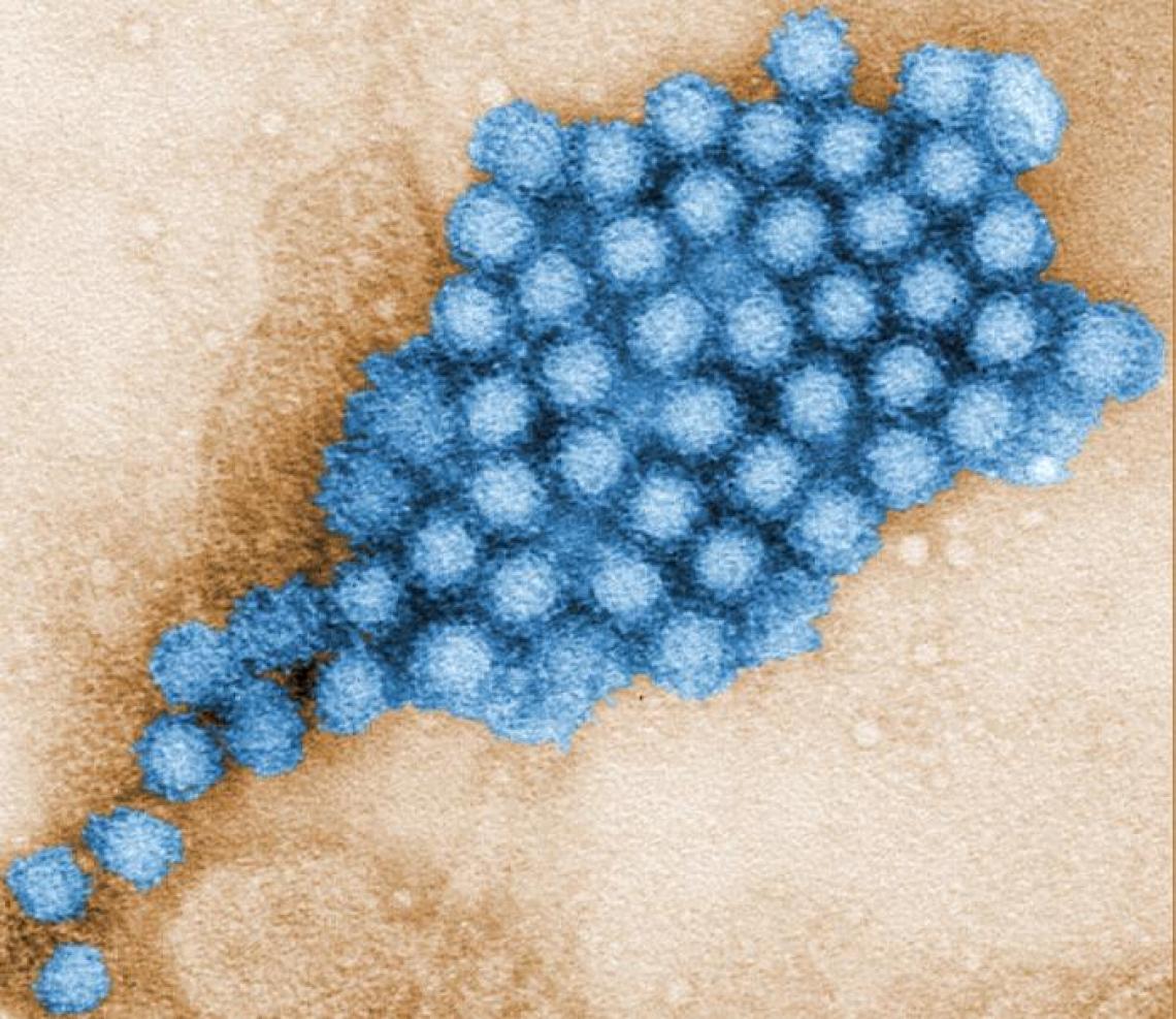 Norovirus particles have a tough outer shell that makes them persistent in the environment and difficult to eliminate.