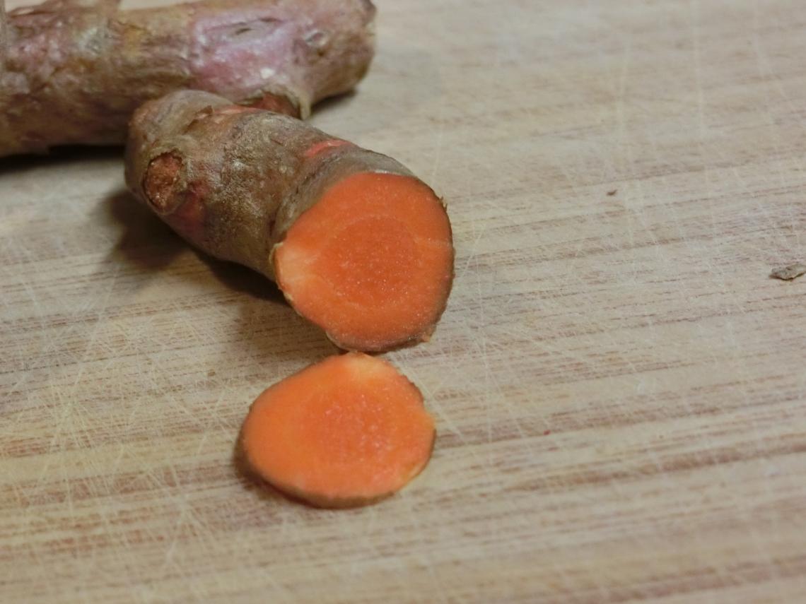 Dr. Janet Funk is leading a clinical trial to investigate the anti-inflammatory impact of turmeric, a natural supplement and Indian spice. Dr. Janet Funk is leading a clinical trial to investigate the anti-inflammatory impact of turmeric, a natural supplement and Indian spice.